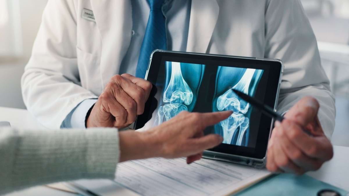 6 simptome ale gonartrozei pe care nu ar trebui sa le ignori