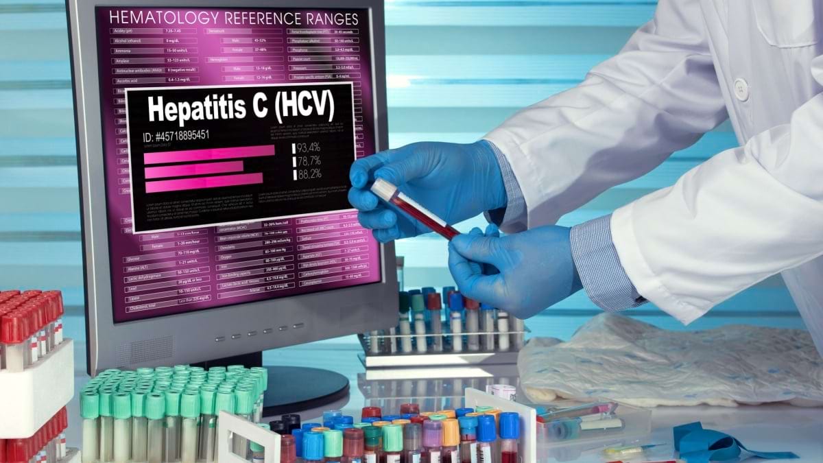 Cine ar trebui sa se testeze pentru hepatita C?