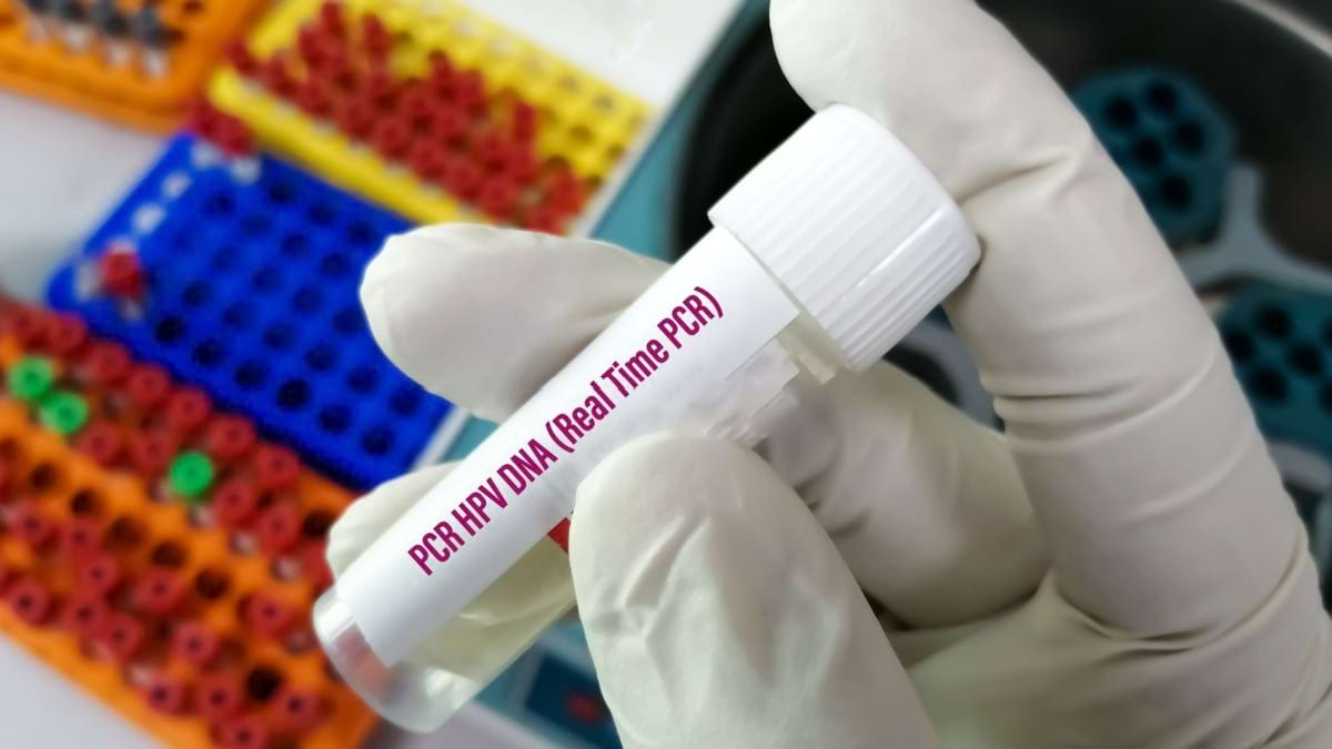 Cum afli ce tulpină HPV ai și care sunt cele mai periculoase?