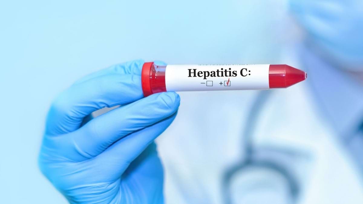 Hepatita C - mai grava la femei sau la barbati?
