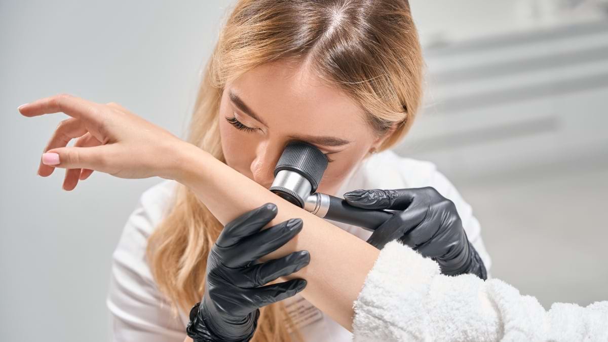 Cercetatorii australieni au descoperit cum sa impiedice raspandirea melanomului