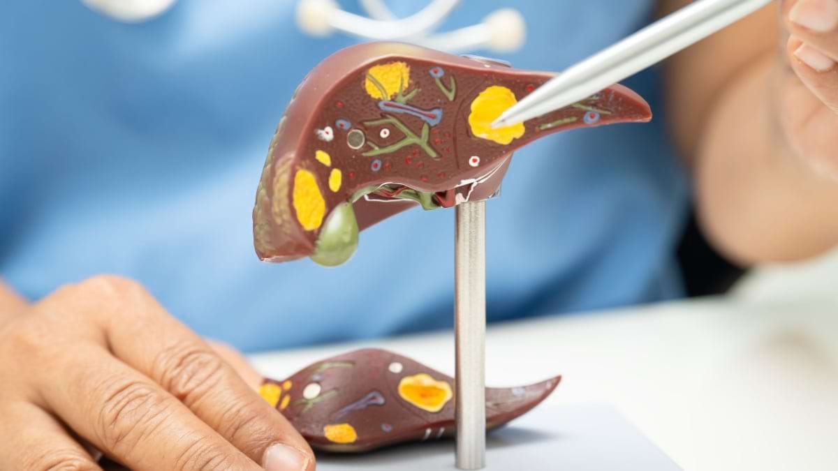 Stadiile fibrozei in hepatita C