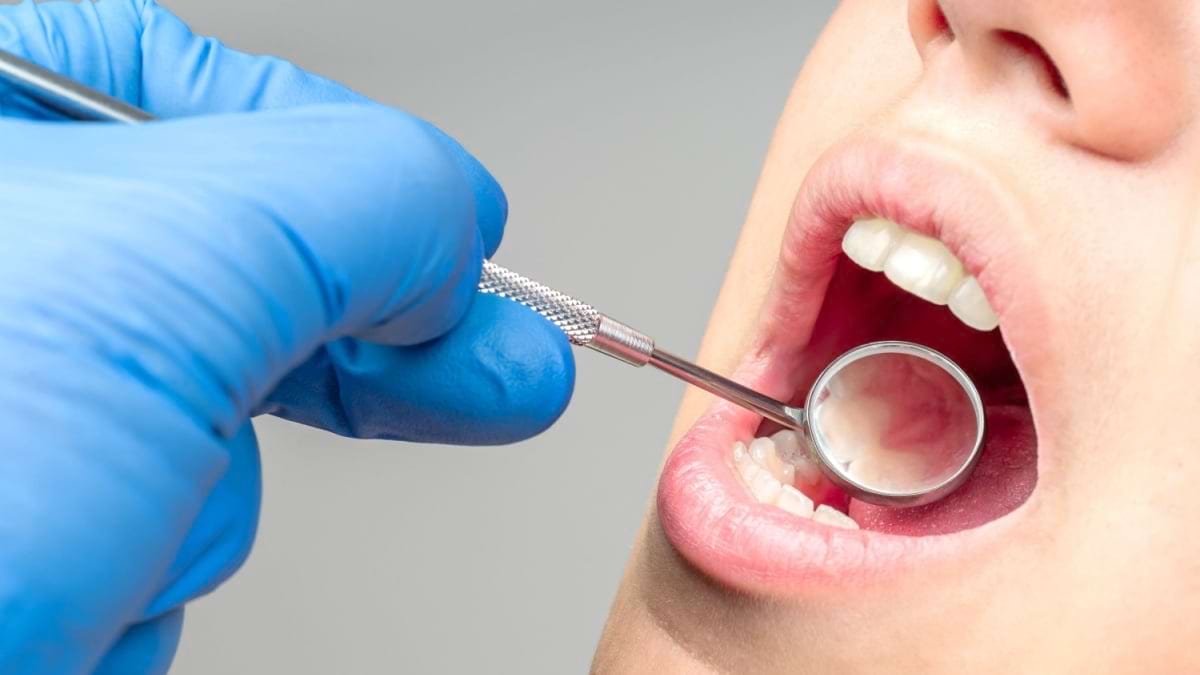 Afecțiunile gingivale: gingivita și parodontita