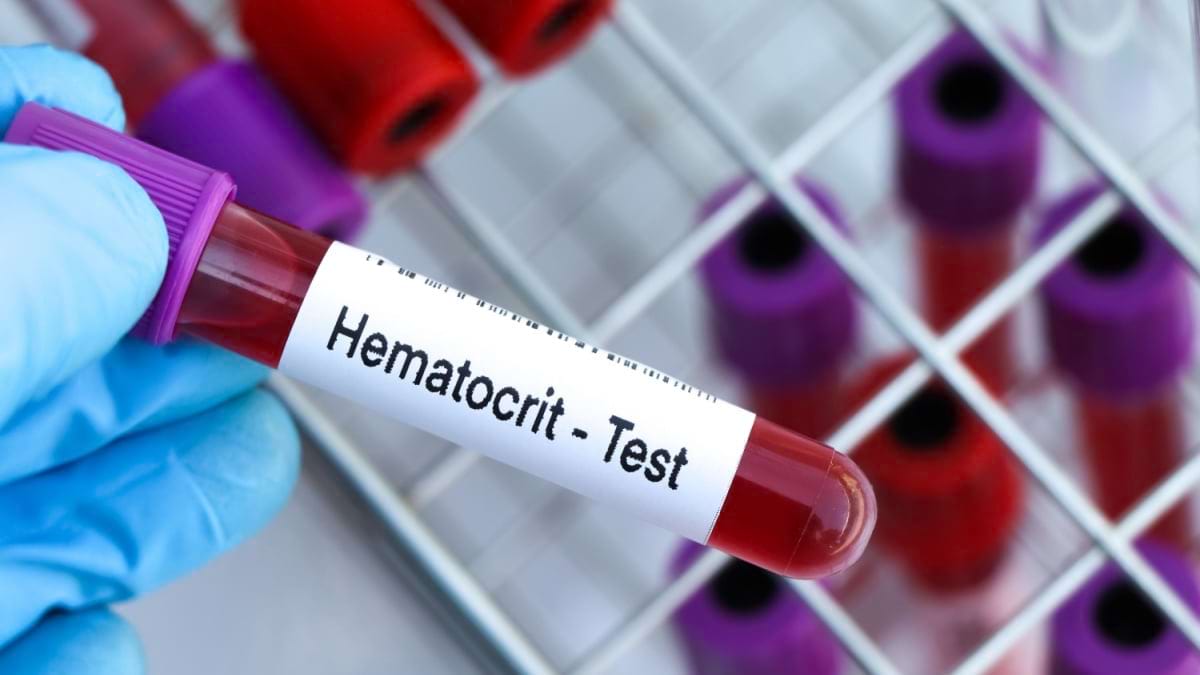 Ce înseamnă hematocrit scăzut?
