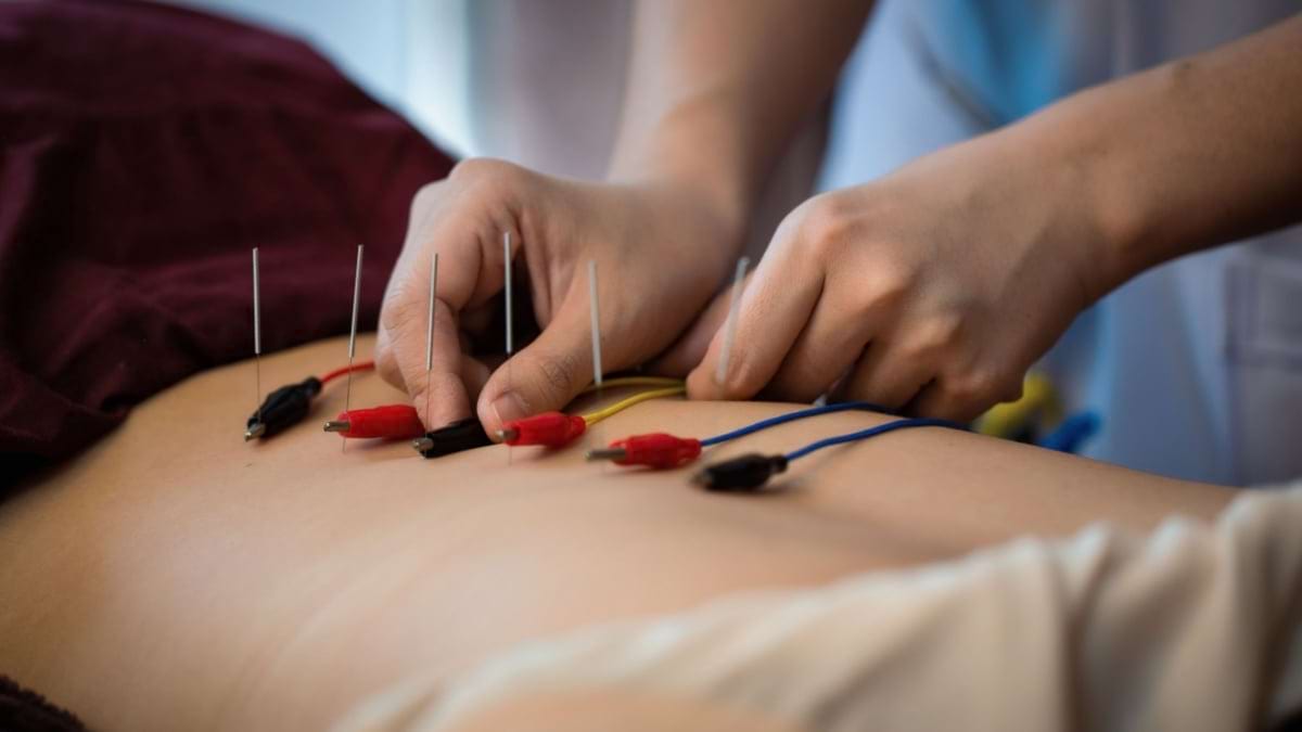 Electroacupunctura: ce este și când se recomandă?