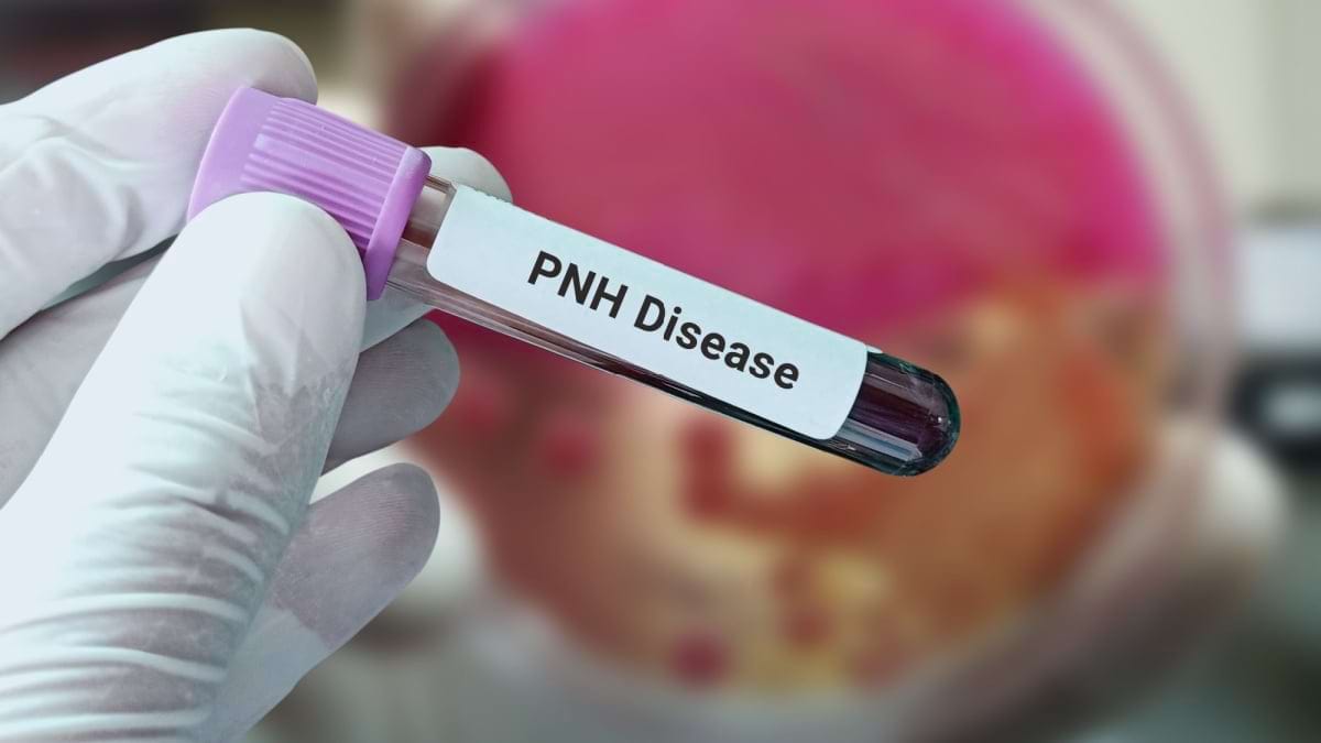 Totul despre hemoglobinurie paroxistică nocturnă (HPN) și tratamentul cu ravulizumab