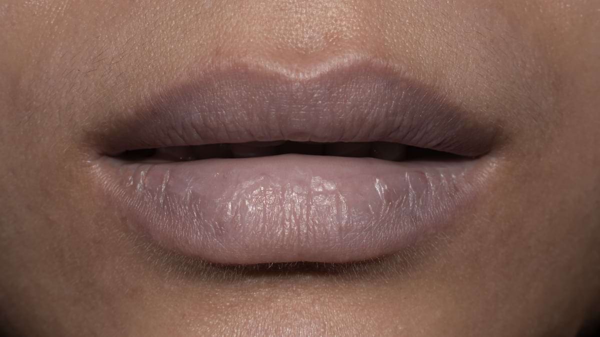 Buzele vinete semnalează lipsa de oxigen