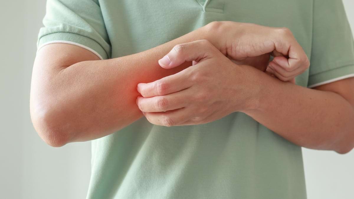Mâncărimile pielii: cauze și tratament