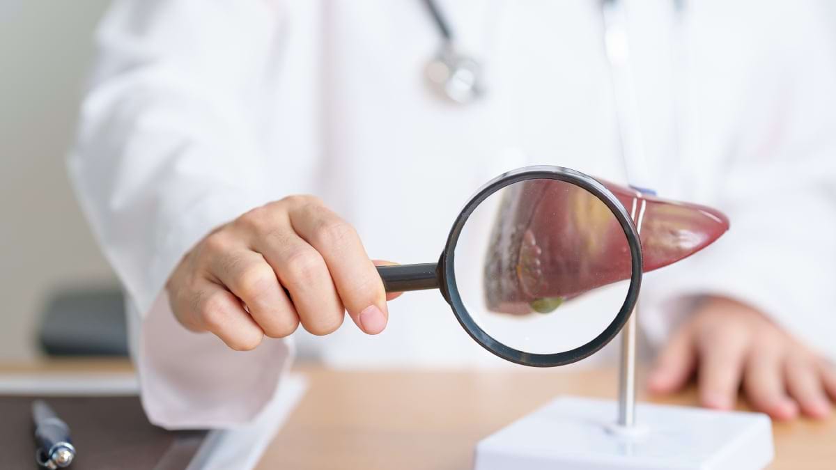 Factorii care accelereaza evolutia hepatitei C spre ciroza