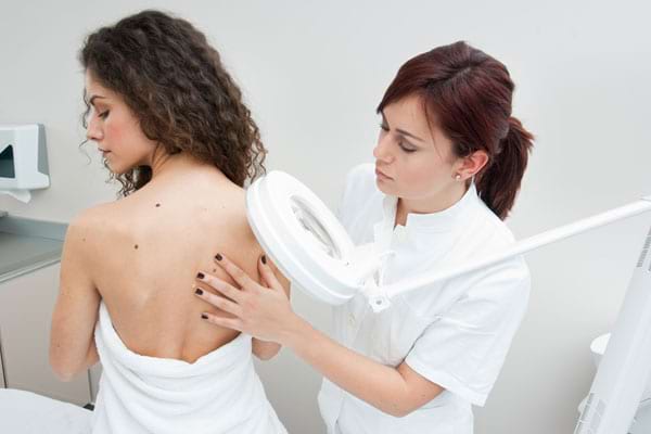 Cancer De Piele Semne De Alarma Cauze Tratamente Comunitati